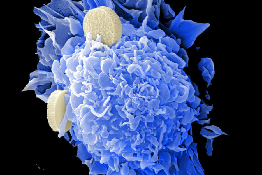 Cancer Killing Nanoparticles