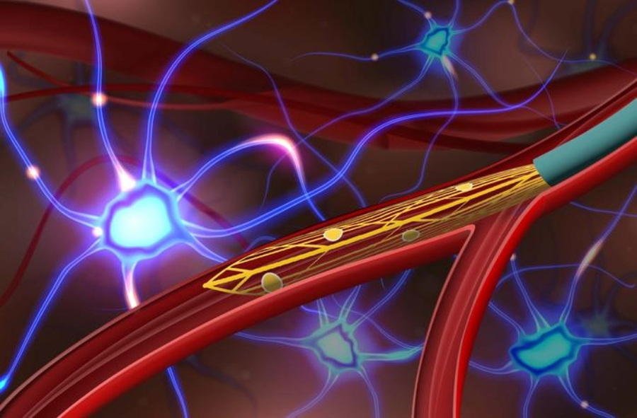 Integration of wireless data transmission in Endovascular probe