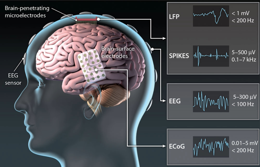 Brain-Machine Interface Technologies